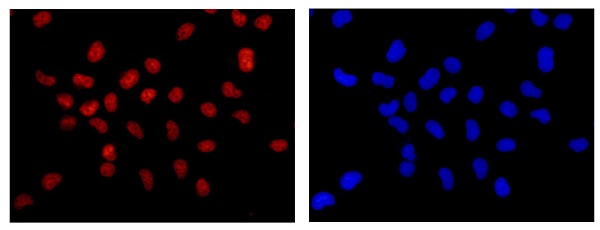 Immunofluorescent analysis of formaldehyde fixed HeLa cells labeling PRPF8 using ab185547 at a 1/250 dilution. A Goat anti rabbit IgG (Alexa Fluor®555) was used as the secondary at a 1/200 dilution.