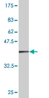 Western blot against tagged recombinant protein immunogen using ab57748 PRPS2 antibody at 1ug/ml.