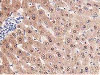 ab119032, at 1/150 dilution, staining PRPSAP2 in paraffin-embedded Human liver tissue by Immunohistochemistry.