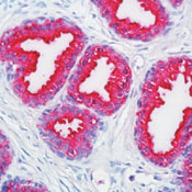 Formalin-fixed, paraffin-embedded human prostate stained with ab80717 at a 1/1500 dilution using alkaline phosphatase-conjugate and fast red chromogen. Note intense cytoplasmic staining of glandular epithelial cells.