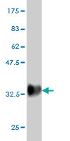 Western blot against tagged recombinant protein immunogen using ab56338 PSCA antibody at 1ug/ml. 
