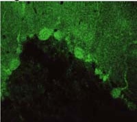Immunolocalization of PSD-93 in rat cerebellum using ab2930.