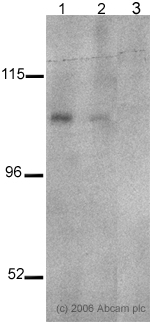 Lanes 1 & 3 :  Anti-PSD95 (phospho S418) antibody (ab16493) at 1 µg/mlLane 2 :  Anti-PSD95 (phospho S418) antibody (ab16493) at 0.5 µg/mlLane 1 : mouse brainLane 2 : mouse brainLane 3 : mouse brain with Mouse PSD95 (phospho S418) peptide (ab17216) at 2 µg/mlLysates/proteins at 20 µg per lane.