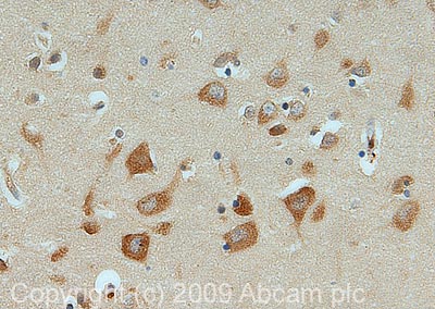 IHC image of PSD95 (Phospho T19) staining in human Hippocampus FFPE section, performed on a BondTM system using the standard protocol F. The section was pre-treated using heat mediated antigen retrieval with sodium citrate buffer (pH6, epitope retrieval solution 1) for 20 mins. The section was then incubated with ab16496, 1µg/ml for 15 mins at room temperature and detected using an HRP conjugated compact polymer system. DAB was used as the chromogen. The section was then counterstained with haematoxylin and mounted with DPX