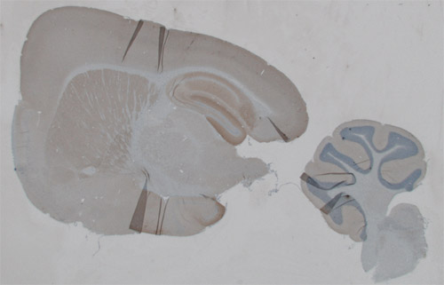ab12093 PSD95 antibody immunostaining brain tissue (4% PFA perfused paraffin embedded 5 micron saggital section). ab12093 was used at 10 µg/ml for a 20 minute incubation at 37 degrees C (on a Ventana Discovery slide processor). Light antigen retrieval and then light protease treatment is recommended before addition of primary antibody ab12093 in this paradigm.