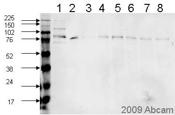 All lanes : Anti-PSD95 antibody (ab12093) at 1/5000 dilutionLane 1 : rat cortical lysateLane 2 : mouse cortical lysateLane 3 : BA21 human cortical lane lysateLane 4 : BA21 human cortical lane lysateLane 5 : BA21 human cortical lane lysateLane 6 : BA21 human cortical lane lysateLane 7 : BA21 human cortical lane lysateLane 8 : BA21 human cortical lane lysateLysates/proteins at 20 µg per lane.SecondaryAlexafluor 680Performed under reducing conditions.