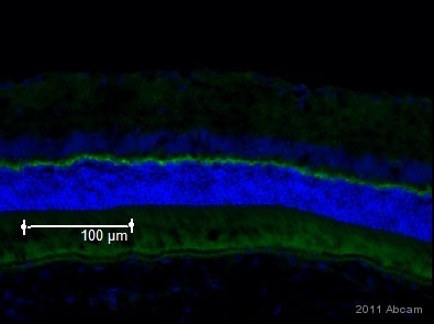 ab18258 staining PSD95 in rat retinal tissue by Immunohistochemistry (Frozen sections).Tissue was fixed with paraformaldehyde, blocked using 10% serum for 30 minutes at 24°C, then incubated with ab18258 at a 1/1000 dilution for 16 hours at 4°C. The secondary used was an Alexa Fluor 488 conjugated goat anti-rabbit polyclonal used at a 1/1000 dilution.See Abreview