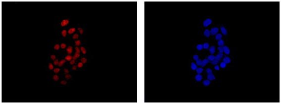 Immunofluorescent analysis of 4% paraformaldehyde-fixed HepG2 cells labeling PSF1 with ab181112 at 1/500 dilution followed by Goat anti rabbit IgG (Alexa Fluor® 555) secondary antibody at 1/200 dilution. Counter stained with Dapi (blue).