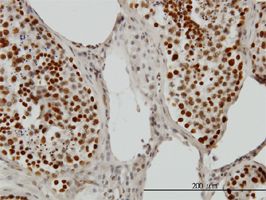 PSIP1 antibody (ab56841) used in immunohistochemistry at 3ug/ml on formalin fixed and paraffin embedded human testis.