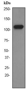 Anti-PSMA antibody [EP3253] (ab76104) at 1/5000 dilution + LnCaP cell lysate at 10 µgSecondaryHRP labelled goat anti-rabbit at 1/1000 dilution