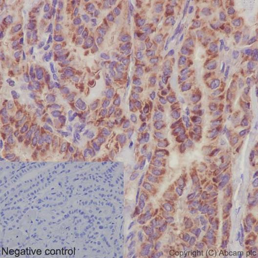 Immunohistochemical analysis of paraffin-embedded, Human papillary adenocarcinoma of thyroid tissue labeling PSMA4 with ab191403 at a 1/2000 dilution (1μg/ml). Counter stained with hematoxylin. In the negative control PBS was used instead of primary antibody.