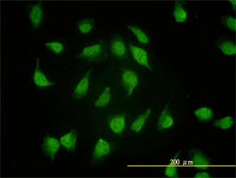 PSMA4 antibody (ab55625) used in immunofluorescence at 1-5ug/ml on HeLa cells.