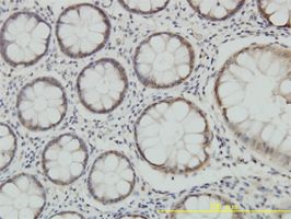 PSMA7 antibody (ab55626) used in immunohistochemistry at 5ug/ml on formalin fixed and paraffin embedded human colon tissue.
