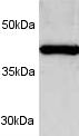 Western blot on partially purified human 19S proteasome using ab3321.