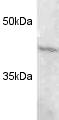 Western blot of proteasome 19S subunit S8 on HeLa cell lysate using ab3323.