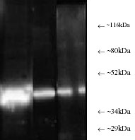 Lane 1 :  Anti-PSMC6 antibody [p42-23] (ab22639) at 1/5000 dilution (Identification of 44KDa Rpt4 in HeLa S3 cytosolic preparation)Lane 2 :  Anti-PSMC6 antibody [p42-23] (ab22639) at 1/5000 dilution (Identificaition of purified protein)Lane 3 :  Anti-PSMC6 antibody [p42-23] (ab22639) at 1/5000 dilution (Identification of proteasome in human placenta )Lane 1 : As aboveLane 2 : As aboveLane 3 : As abovedeveloped using the ECL techniqueObserved band size : 44 kDa (why is the actual band size different from the predicted?)Exposure time :  1 minute