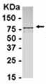 Anti-PSMD1 antibody (ab37759) at 1/2000 dilution + E coli derived fusion protein at 2.5 µgSecondaryGoat anti IgY HRP at 1/1000 dilution