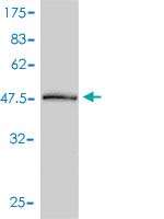 Western blot against tagged recombinant protein immunogen using ab58120 PSME2 antibody at 1ug/ml.