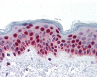 ab119285, at 5 µg/ml, staining PTBP1 in Formalin-fixed, Paraffin-embedded Human Skin tissue by Immunohistochemistry.