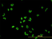 ab119285 at 10µg/ml dilution staining PTBP1 in HeLa cells by Immunofluorescence.