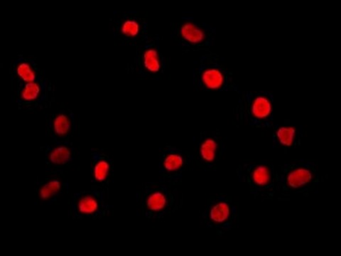 Immunofluorescent staining of PTBP1 in A549 cells, using ab133734 at a 1/250 dilution.