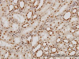 PTBP1 antibody (ab58131) used in immunohistochemistry at 3ug/ml on formalin fixed and paraffin embedded human kidney.