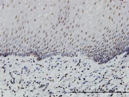 PTF1A antibody (ab57257) used in immunohistochemistry at 3ug/ml on formalin fixed and paraffin embedded human esophagus.