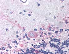 Human Brain, Cerebellum (formalin-fixed, paraffin-embedded) stained with ab115667 at 4 ug/ml followed by biotinylated goat anti-rabbit IgG secondary antibody, alkaline phosphatase-streptavidin and chromogen.