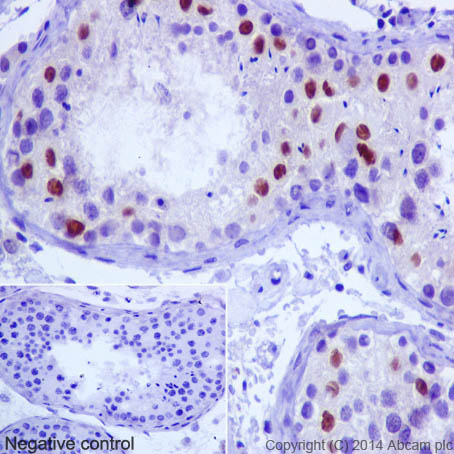 Immunohistochemical analysis of paraffin-embedded Human testis tissue labeling NR0B1 / Dax1 with ab196649 at 1/1000 dilution followed by Goat Anti-Rabbit IgG H&L (HRP) (ab97051) at 1/500 dilution and counter-stained with Hematoxylin. (inset: negative control).Note: Nuclear staining on human testis tissue was observed.