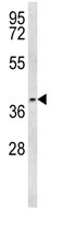Anti-PTGER3 antibody - N-terminal (ab94994) at 1/100 dilution + Ramos cell line lysates at 35 µg