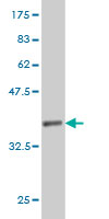 Western blot against tagged recombinant protein immunogen using ab57769 PTGES2 antibody at 1ug/ml.