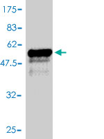 Western blot against tagged recombinant protein immunogen using ab55631 PTHLH antibody at 1ug/ml.