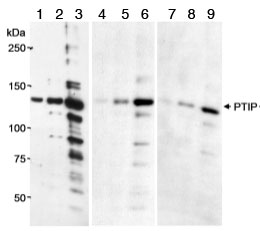 Lanes 1, 4 & 7 : Anti-PTIP antibody (ab70434) at 0.25 µg/mlLanes 2, 5 & 8 : Anti-PTIP antibody (ab70434) at 0.1 µg/mlLanes 3, 6 & 9 : Anti-PTIP antibody (ab70434) at 0.025 µg/mlLane 1 : Whole cell lysate from 293T cells at 5 µgLane 2 : Whole cell lysate from 293T cells at 15 µgLane 3 : Whole cell lysate from 293T cells at 50 µgLane 4 : Whole cell lysate from 293T cells at 5 µgLane 5 : Whole cell lysate from 293T cells at 15 µgLane 6 : Whole cell lysate from 293T cells at 50 µgLane 7 : Whole cell lysate from 293T cells at 5 µgLane 8 : Whole cell lysate from 293T cells at 15 µgLane 9 : Whole cell lysate from 293T cells at 50 µgdeveloped using the ECL technique