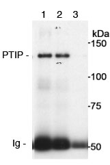30ug of whole cell lysate from 293T cells were immunoprecipitated using ab70434 at 10, 5 and 1ug/mg of lysate respectively in lanes 1, 2 and 3. For the subsequent blot ab70434 was used at 0.25ug/ml.