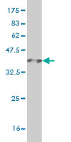 Western blot against tagged recombinant protein immunogen using ab56934 PTIP antibody at 1ug/ml.