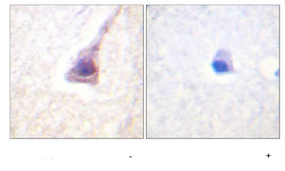 ab5419, at a 1/50 dilution, staining paraffin embedded human brain tissue sections by Immunohistochemistry in the absence (left image) or presence (right image) of the phosphopeptide.