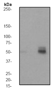 All lanes : Anti-PTP1B (phospho S50) antibody [EP1838Y] (ab62320) at 1/5000 dilutionLane 1 : Hela cell lysate - untreated cellsLane 2 : Hela cell lysate - treated with Calyculin ALysates/proteins at 10 µg per lane.Secondarygoat anti-rabbit HRP at 1/2000 dilution