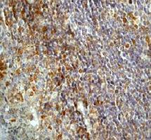 ab75856, at 1/50 dilution, staining PTP1B in human tonsil, by Immunohistochemistry using formalin-fixed, paraffin-embedded tissue.
