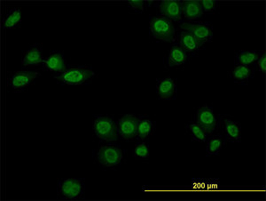 ab115552 at 10µg/ml dilution staining NR1D1 in HeLa cells by Immunofluorescence.