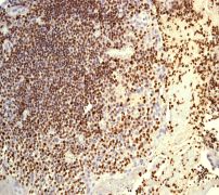 ab76542, at 1/100 dilution, staining PU.1/Spi1 in paraffin-embedded human tonsil tissue by immunohistochemistry.