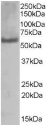 Anti-PUF60 antibody (ab22819) at 1 µg/ml + A431 lysate (35µg protein in RIPA buffer).