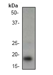 Anti-PUMA antibody [EP512Y] (ab33906) at 1/5000 dilution + K562 cell lysate.