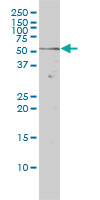 NR1D2 antibody (ab56913) at 1ug/lane + HeLa cell lysate at 25ug/lane.
