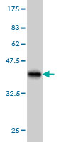 Western blot against tagged recombinant protein immunogen using ab57049 Pumilio 2 antibody at 1ug/ml.