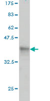 Western blot against tagged recombinant protein immunogen using ab57873 PVRL4 antibody at 1ug/ml.