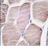 ab63158, at a 1/10 dilution, staining PYGM in formalin fixed, paraffin embedded human skeletal muscle tissue by Immunohistochemistry. ab63158 was peroxidase-conjugated to the secondary antibody, followed by DAB staining.