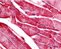 ab60982, at a concentration of 20µg/ml, staining PYGM in formalin fixed paraffin embedded human skeletal muscle tissue sections by Immunohistochemistry.