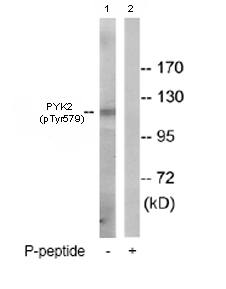 All lanes : Anti-PYK2 (phospho Y579) antibody (ab78209) at 1/500 dilutionLane 1 : Extracts from 3T3 cellsLane 2 : Extracts from 3T3 cells plus 5µg immunizing peptideLysates/proteins at 5 µg per lane.