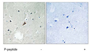 Immunohistochemistry analysis of paraffin-embedded human brain tissue using ab78209 at a 1/50 dilution.Left image un-treated.Right image treated with immunizing peptide.