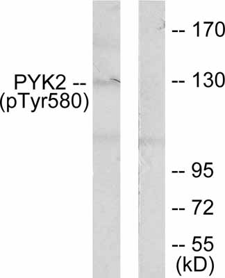 All lanes : Anti-PYK2 (phospho Y580) antibody (ab52209) at 1/500 dilutionLane 1 : Extracts from K562 cells with no immunising peptideLane 2 : Extracts from K562 cells with immunising peptide